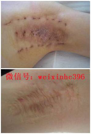 狐臭到底是一种怎样的体验,进来看看你就疯狂了