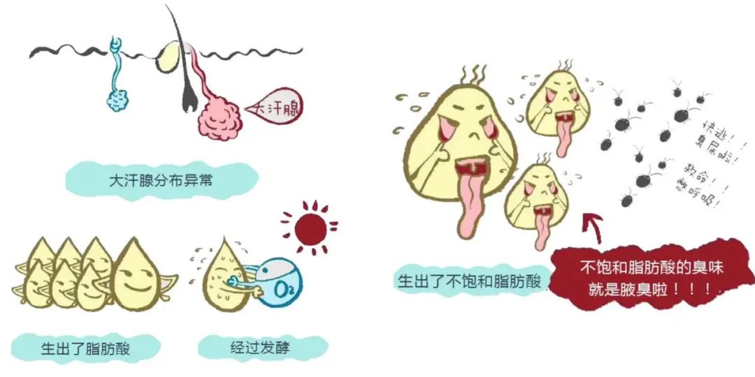 腋臭公益援助诊疗报名啦!880元微创手术+专病名医义诊,就3天!