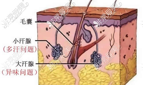 深圳除腋臭技术特点分析,还有当地除腋臭好医院介绍!-非常爱美