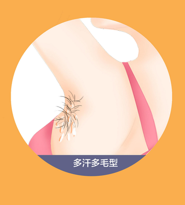 狐臭 腋臭 腋下出汗 汗腺 青春期腋臭 .